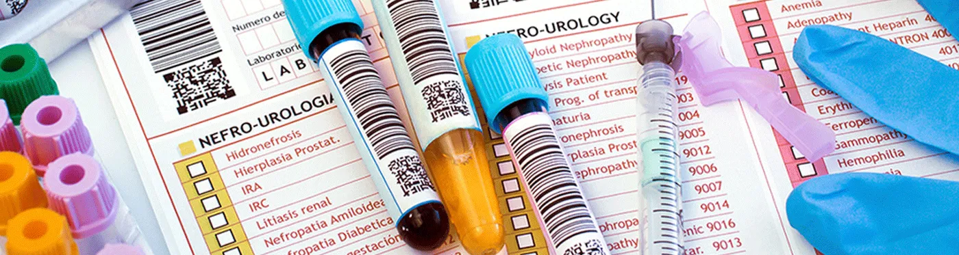 Blood Test Vials